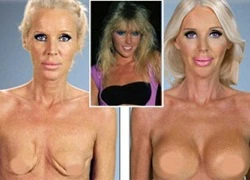 Nữ diễn viên Hollywood bị virus ăn mất ngực