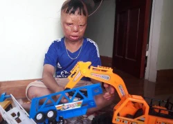 Cậu bé bị cha ruột tẩm xăng đốt ước mơ làm lính cứu hỏa