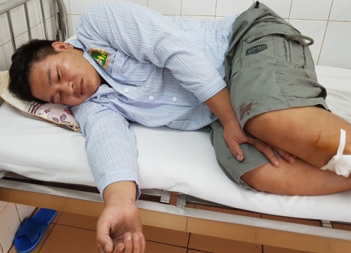 Khởi tố tài xế vi phạm giao thông, chém 3 công an bị thương