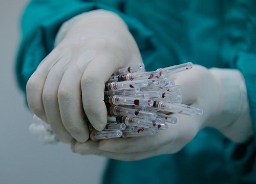 Thử nghiệm vaccine Covid-19 trên người cần dựa trên những tiêu chí nào?