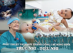 Successful surgery to separate 2 twins, a miracle made from the heart.