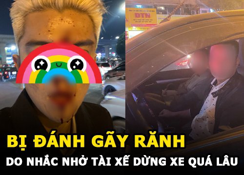 Bị đánh gãy răng do nhắc nhở tài xế dừng xe quá lâu gây tắc đường