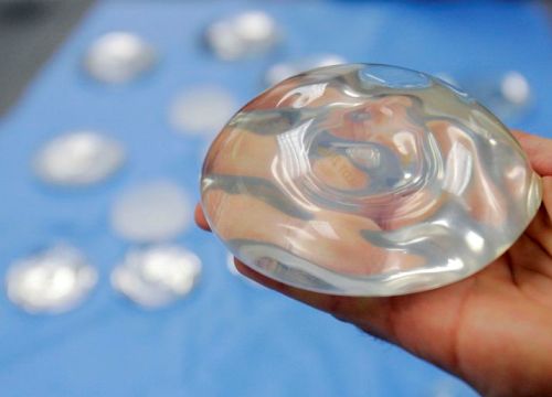 FDA Mỹ ra cảnh báo mạnh mẽ về phẫu thuật nâng ngực
