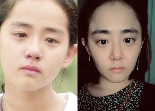 &quot;National little sister&quot; Moon Geun Young is aging uncontrollably at the age of 34, fans are worried due to psychological effects because of &quot;no help&quot;