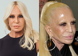 Donatella Versace - Từ Nữ vương đế chế thời trang đến thảm họa thẩm mỹ mọi thời đại