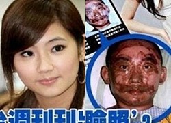 Selina (SHE) - Burned face disfigured by bomb explosion, divorced by her husband because of &quot;difficulty in sex&quot;