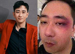 Vuong Tu Kien haunts his wife, taekwondo champion, slaps 500 times, hospitalized 8 times, and was &quot;robbed&quot; of all his assets