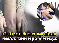 12-year-old girl suspected of being abused by her mother, her mother&#39;s lover repeatedly abused her