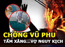 Chồng vũ phu tẩm xăng thiêu vợ nguy kịch - Gia đình văn hoá?