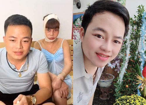 Cô dâu 62 tuổi xuất hiện sau biến chứng thẩm mỹ, nhưng gương mặt giống "búp bê sứ" của chồng trẻ mới gây chú ý