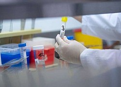 Dong Thap - 2 more suspected cases of SARS-CoV-2 infection