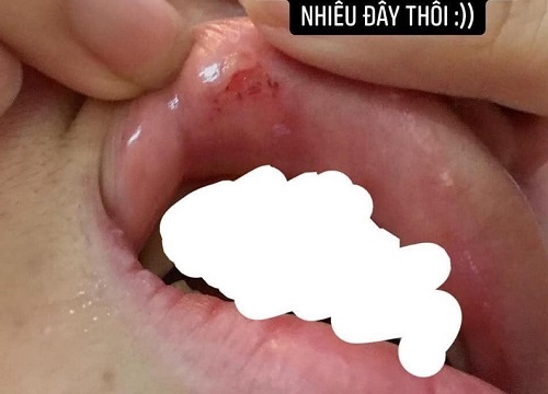 Từ thanh niên 'đào mỏ' đến 'boy phố cổ' đánh đập người yêu sảy thai: Điểm danh loạt bạn trai khiến hội chị em nguyện... không thoát ế!