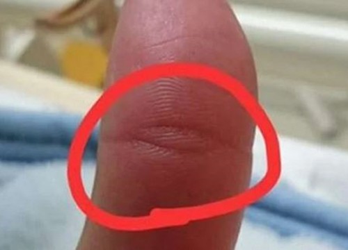 Có vân mắt Phật ở ngón tay này, cuộc đời bạn sẽ an nhiên, tự tại
