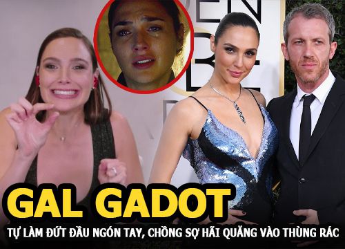 Gal Gadot - Người đẹp Wonder Woman tự chặt đứt đầu ngón tay, chồng sợ hãi quăng luôn vào thùng rác