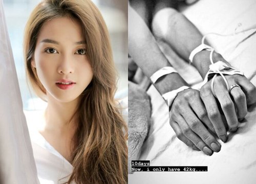 Kha Ngan &quot;Descendants of the Sun&quot; coughed up blood, her hands were covered with needles, her limbs were thin