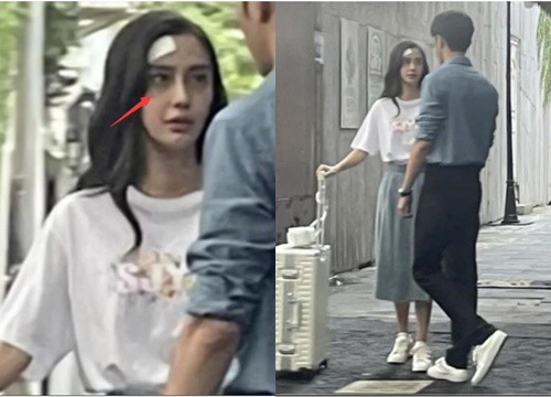 Angelababy lộ mắt thâm quầng, gầy trơ xương, xuống sắc thấy rõ