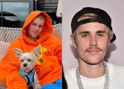 Justin Bieber mắc bệnh hiếm gặp dẫn đến xuống sắc không phanh