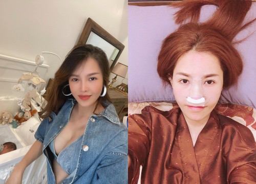 Que Van admits to having the most surgery in Vietnam: 6 times nose job, 24 sets of teeth