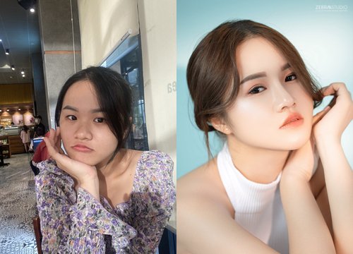 "Vịt hóa thiên nga" - Cô gái đại phẫu thẩm mỹ "lột xác" đầy bất ngờ