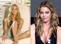 Denise Richards disappoints with a deformed face because of aesthetics