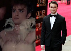 "Harry Potter" Daniel Radcliffe bung xõa táo bạo "phơi bày" vòng 3