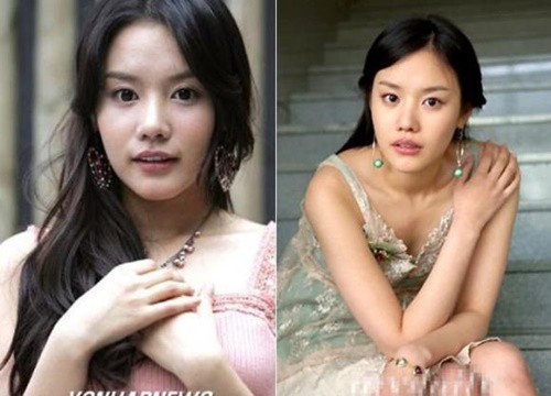 Kim Ah Joong "Sắc đẹp ngàn cân" thay đổi không ai nhận ra hậu dao kéo?