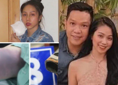 NÓNG: Đích thân cha ruột bé gái 8 tuổi xoá dữ liệu camera để che giấu cho "dì ghẻ" bạo hành