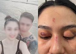 &quot;Big brother in District 8&quot; posted a photo of his wife being assaulted by Trang Nemo shop, saying a warm sentence: &quot;Ck won&#39;t let his wife suffer&quot;