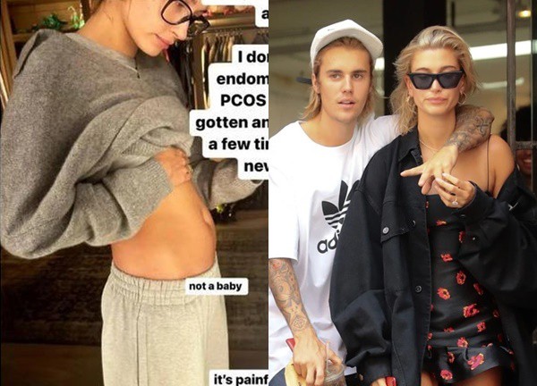 Vợ Justin Bieber xót xa tiết lộ không thể mang thai vì bị u nang buồng trứng, phản ứng chồng ra sao?