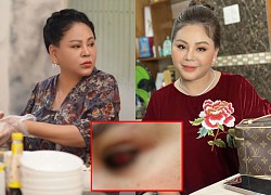 NS Le Giang had a serious accident with a torn cornea, Vietnamese stars were worried about being hospitalized?