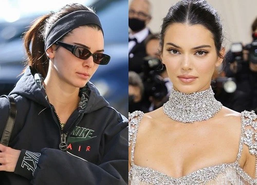 Kendall Jenner - "Siêu mẫu đắt giá nhất thế giới" tiết lộ nỗi khổ thầm kín không phải ai cũng biết!