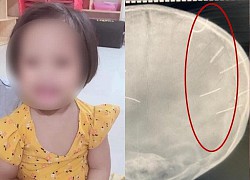 A 3-year-old girl who was &quot;handled by her uncle&quot; has died, discovered in her skull there are 10 nails