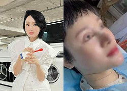 Surgery like Hien Ho to get a G63, the girl who caused a fever in the world