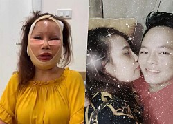 Chấn động thông tin "cô dâu Cao Bằng" qua đời vì biến chứng thẩm mỹ
