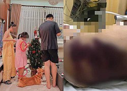 More details about the death of an 8-year-old girl: Nguyen Trung Kim Thai is more cruel than her step-aunt