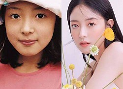 Lee Se Young - Sao nhí "Dae Jang Geum" vào showbiz vì sợ bị bắt cóc, bạn tẩy chay vì nổi tiếng