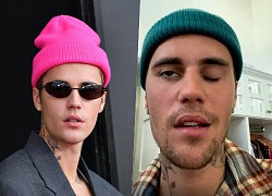 Justin Bieber bị liệt nửa mặt do nhiễm virus hiếm