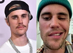 Justin Bieber ngưng hát: Không còn khả năng biểu diễn vì bị liệt mặt?