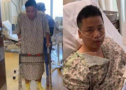 Khoa Pug sheds tears and learns to walk painfully after leg traction surgery