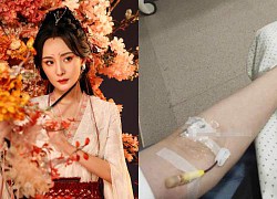 Yang Mi is hospitalized urgently: Management company updates the situation