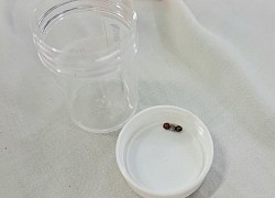 Bé gái 3 tuổi thủng ruột vì món đồ chơi quen thuộc