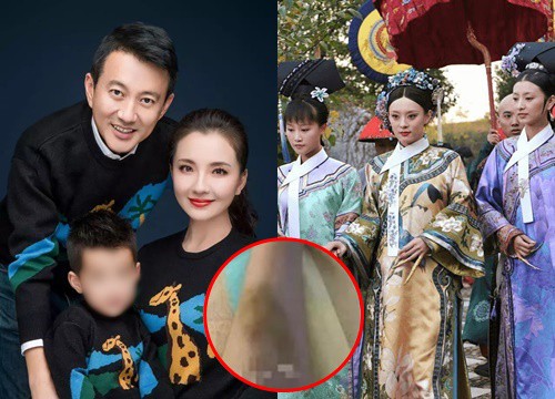 Tôn Tây "Hậu cung Chân Hoàn truyện" nghi bị chồng bạo hành, vén màn sự thật cuộc hôn nhân trong mơ?