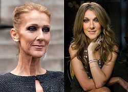 Celine Dion: Poor childhood, the pain of infertility, relatives died one after another, now suffering from a strange disease