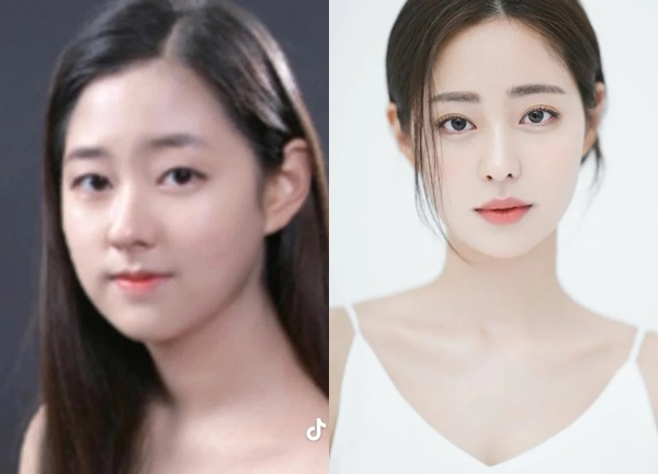 Lộ ảnh trước thẩm mỹ của Hoa hậu hot nhất Địa Ngục Độc Thân 2, nhan sắc quá khác hiện tại!