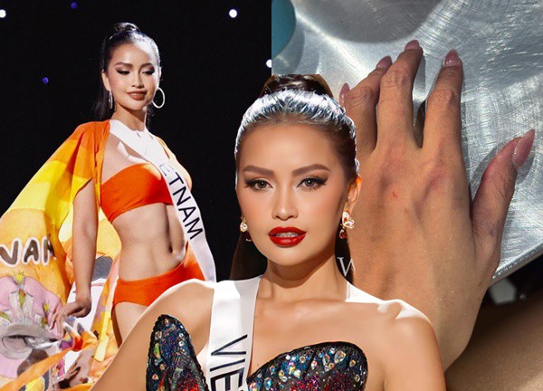 Ngọc Châu chấn thương vẫn lọt top 3 bán kết Miss Universe, chủ mới ưu ái: Tín hiệu đăng quang?