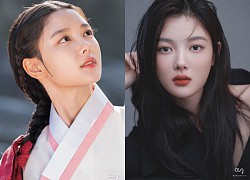 Em gái quốc dân Kim Yoo Jung lột xác hậu can thiệp dao kéo, bật mí chuyện kết hôn vì lợi ích gây bão