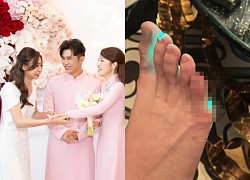 Puka's close friend got injured while attending a wedding and still can't walk normally, fans are screaming Dieu Nhi's name.