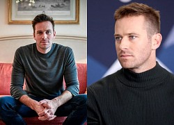 Armie Hammer - &quot;Call Me By Your Name&quot; actor revealed his &quot;shock&quot; for the first time after the shocking Hollywood scandal