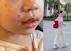 Sending her children to an international school, the young mother is angry when her child is scratched, the school&#39;s attitude is even more reprehensible