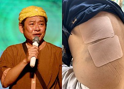 Comedian Tan Beo had bad luck, fell more than 10 stairs to unconsciousness, still stubbornly refused to give up this job.